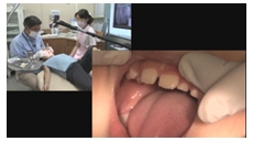 正中埋伏過剰歯の臨床的対応