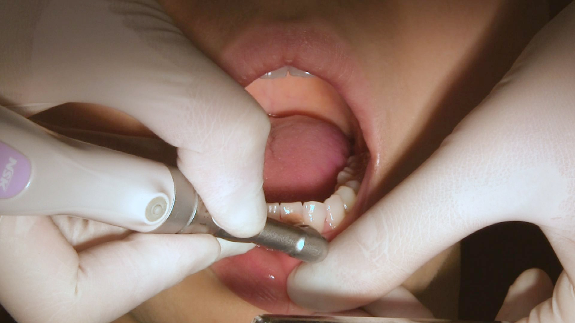 歯科衛生士の 「 心地よいメインテナンスの流れ 」