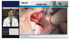 ドライマウス（口腔乾燥症）の原因と対処法