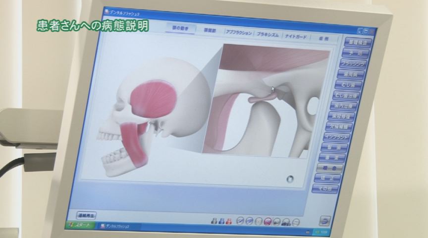 顎関節01