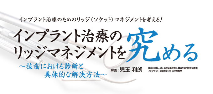 臨床応用できる歯槽堤保存術入門 歯科　DVD