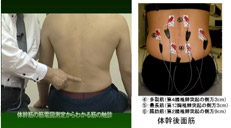 筋緊張異常03
