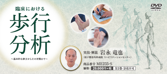 印象から始める歩行分析　ジャパンライム　DVD　リハビリ　理学療法 印象から始める歩行分析【全2巻・分売不可】 印象から始める歩行